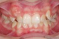 /album/fotogalerie/choc-1-jpg/
